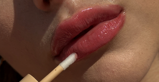 The Secret Behind a Fuller, Softer, More Confident Smile (No Injections. No Filters. Just Results.)