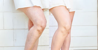 How a Busy Mom Discovered the Secret to Flawless Legs for Every Occasion