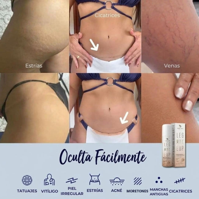 Oculta várices, estrías, cicatrices, tatuajes y manchas – antes y después con Leg Makeup